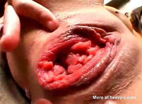 Ugly Vagina Porn