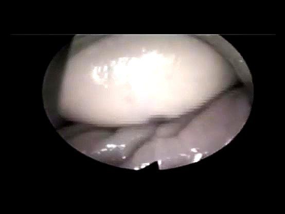 Camera Inside Vagina During Sex - Camera Inside Vagina During Sex Porn Videos | PussySpace