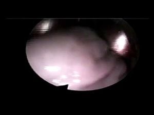Watch Inside View of Sex - Camera Inside Pussy, Inside Pussy ...
